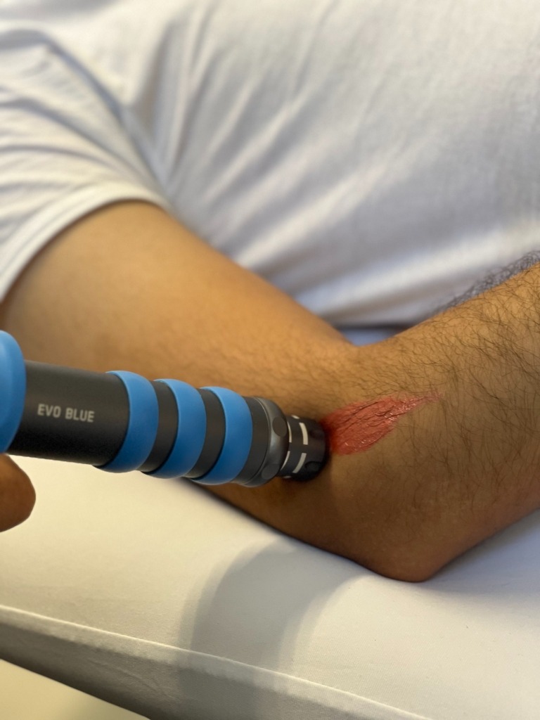 Shock Wave Therapy (SWT)